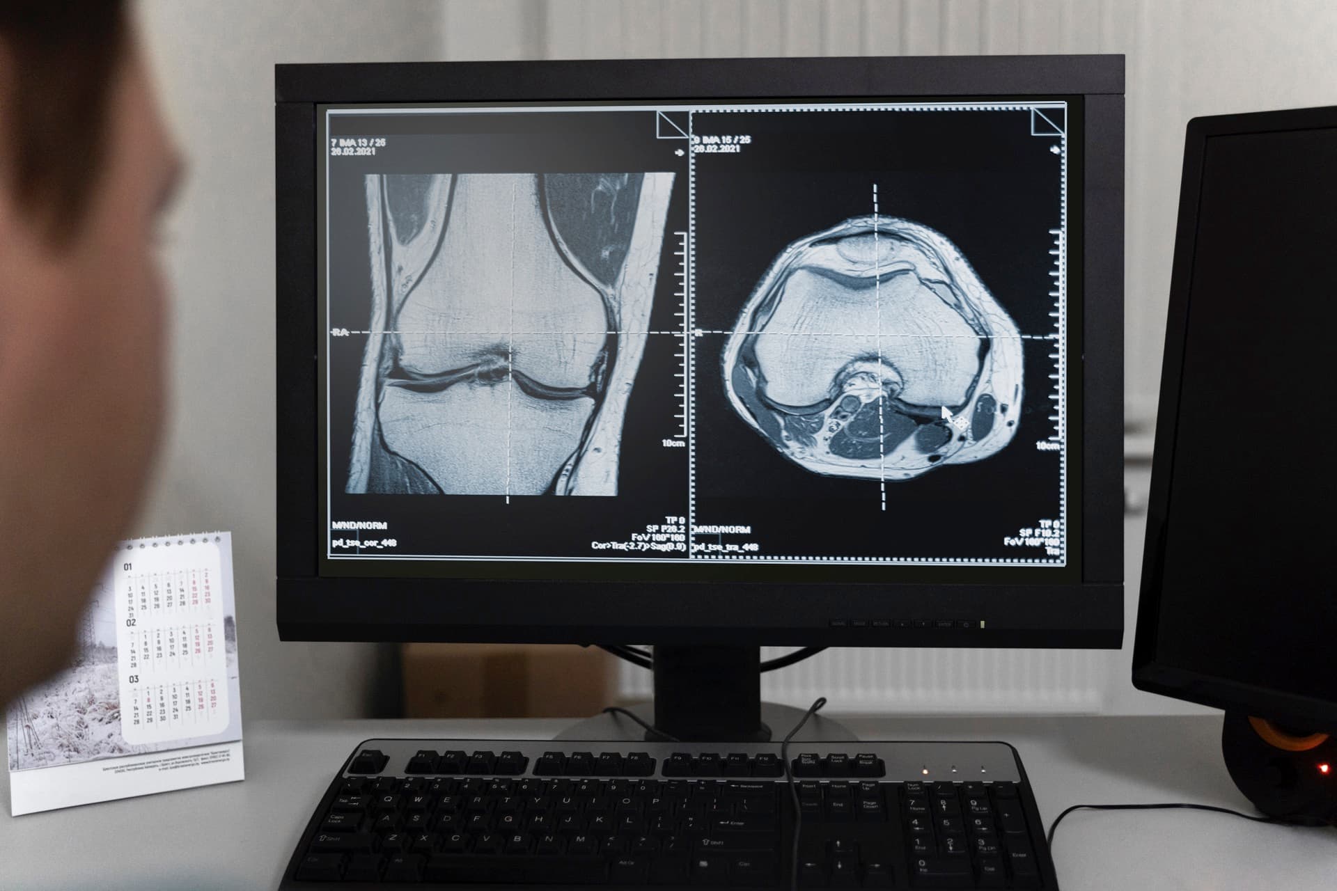 Clinician reviewing knee imaging alongside motion-derived data for early osteoarthritis stratification